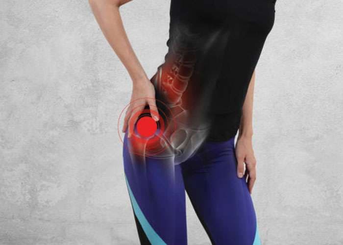 Sciatic nerve pain — lumbar spine and hip anatomy